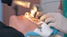 LASIK Mata Solusi Modern untuk Mata Sehat dan Penglihatan Jernih/Ist